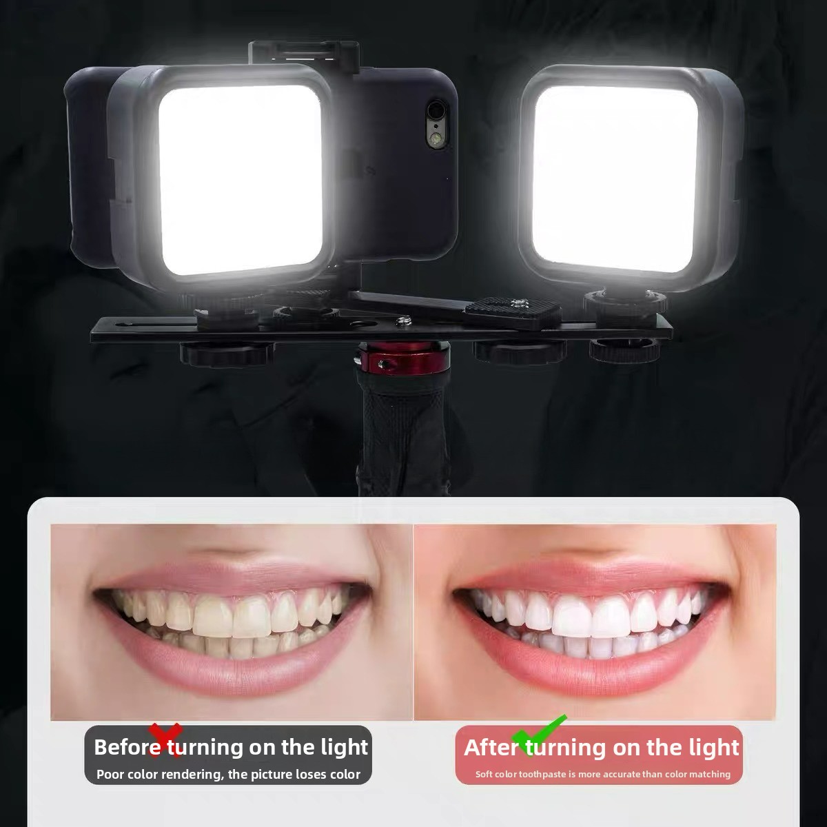 Photography Mobile Lighting - Bluetooth Özellikli Diş Fotoğrafçılığı Işığı, Oral